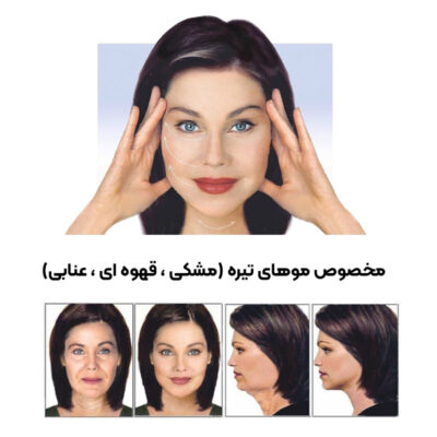 چسب لیفت صورت و شقیقه اصل (20 عددی)