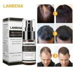 اسپری تقویت رشد مو لانبنا ضدریزش مو حجم 20 میل