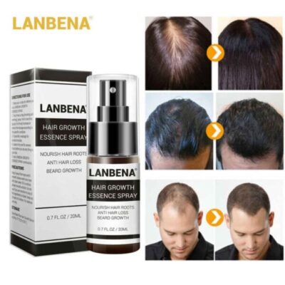 اسپری تقویت رشد مو لانبنا ضدریزش مو حجم 20 میل